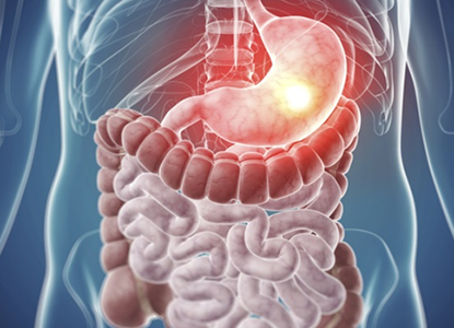 Comprehensive Gastrointestinal Cancer Treatment Care