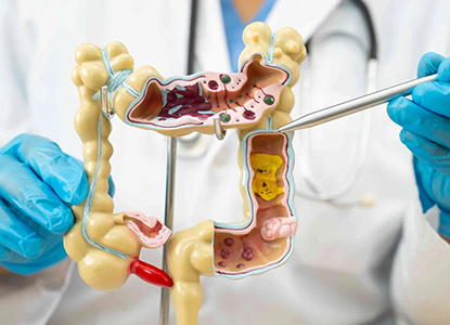 Advanced Colorectal Surgery Techniques 