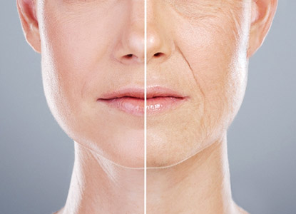 Anti-Aging Treatment in Noida
