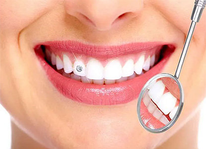 Dental Jewelry Treatment in Dwarka Delhi, Dental Dental Jewelry Treatment in Dwarka Delhi, Best Dental Jewelry Treatment in Dwarka Delhi, Top Dental Jewelry Treatment in Dwarka Delhi, Affordable Dental Jewelry Treatment in Dwarka Delhi, Low Cost Dental Jewelry Treatment in Dwarka Delhi, Dental Jewelry Treatment Price in Dwarka Delhi, Dental Jewelry Treatment Package in Dwarka Delhi, Dental Jewelry Treatment Price in Dwarka Delhi, Dental Jewelry Treatment Clinic in Dwarka Delhi, Dental Jewelry Treatment Doctor in Dwarka Delhi, Dental Jewelry Treatment Dentist in Dwarka Delhi