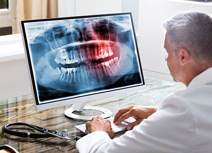 Digital Dental X-Ray in Dwarka Delhi, Dental Digital Dental X-Ray in Dwarka Delhi, Best Digital Dental X-Ray in Dwarka Delhi, Top Digital Dental X-Ray in Dwarka Delhi, Affordable Digital Dental X-Ray in Dwarka Delhi, Low Cost Digital Dental X-Ray in Dwarka Delhi, Digital Dental X-Ray Price in Dwarka Delhi, Digital Dental X-Ray Package in Dwarka Delhi, Digital Dental X-Ray Price in Dwarka Delhi, Digital Dental X-Ray Clinic in Dwarka Delhi, Digital Dental X-Ray Doctor in Dwarka Delhi, Digital Dental X-Ray Dentist in Dwarka Delhi