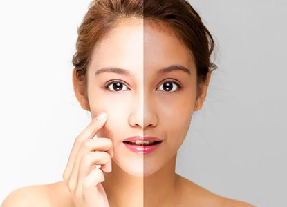 Full Body Whitening Treatment in Noida