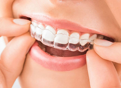 Teeth Invisalign Aligners in Dwarka Delhi, Dental Teeth Invisalign Aligners in Dwarka Delhi, Best Teeth Invisalign Aligners in Dwarka Delhi, Top Teeth Invisalign Aligners in Dwarka Delhi, Affordable Teeth Invisalign Aligners in Dwarka Delhi, Low Cost Teeth Invisalign Aligners in Dwarka Delhi, Teeth Invisalign Aligners Price in Dwarka Delhi, Teeth Invisalign Aligners Package in Dwarka Delhi, Teeth Invisalign Aligners Price in Dwarka Delhi, Teeth Invisalign Aligners Clinic in Dwarka Delhi, Teeth Invisalign Aligners Doctor in Dwarka Delhi, Teeth Invisalign Aligners Dentist in Dwarka Delhi