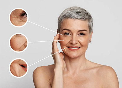 Wrinkles & Fine Lines Treatment In Noida