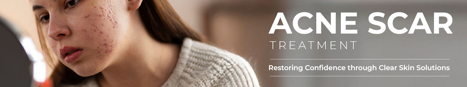 Acne & Acne Scar Treatments
