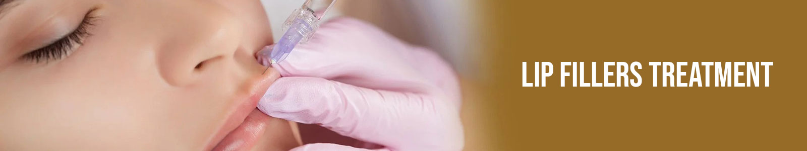 Lip Fillers Treatment