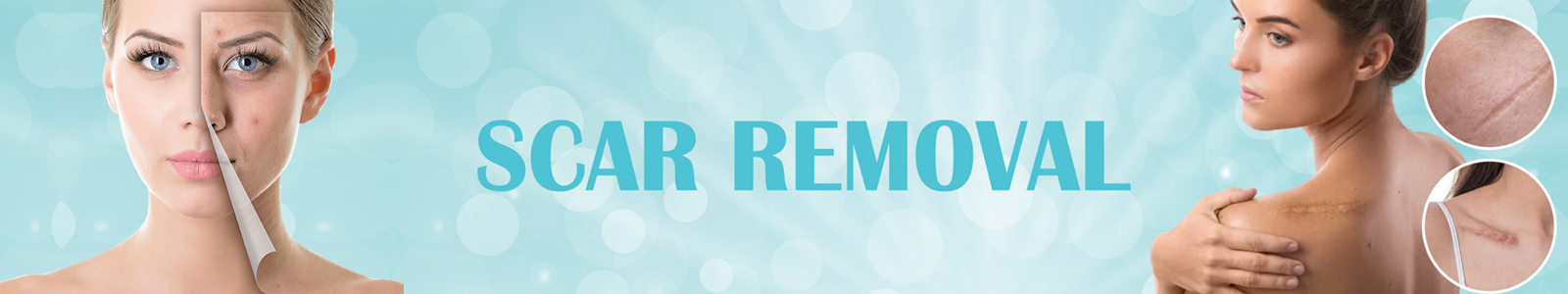 Scar Revision Treatment