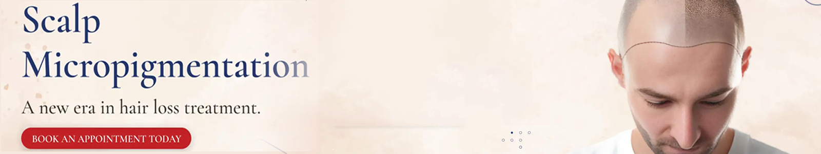 Scalp Micropigmentation Treatment