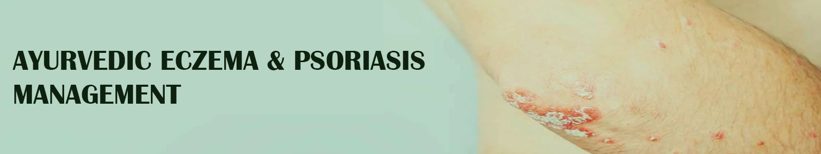 Ayurvedic Eczema & Psoriasis Management
