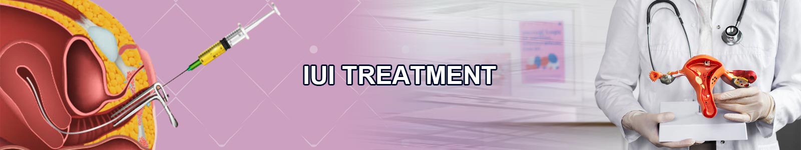 IUI Treatment Provider in India